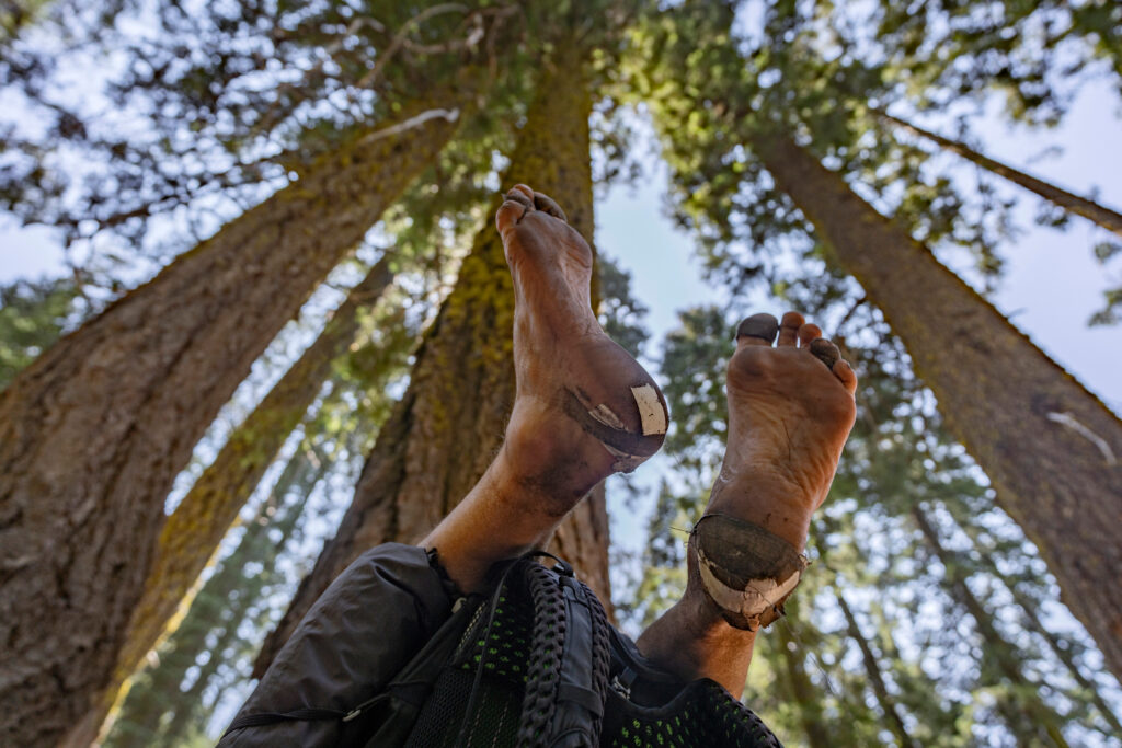 Hugh Safford's feet after four days of hiking on the scorched section of the trail. Moleskin and athletic tape are the only things holding the skin of his heels together. Credit: Bing Lin/Inside Climate News